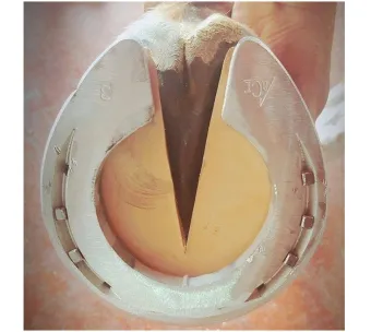 ACR-200 Onion Shoe